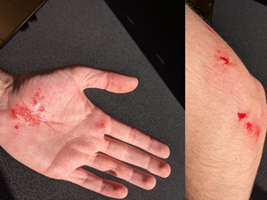 some scratches obtained while learning how to ride a longboard